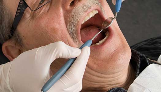 Krav på bättre tandvård till de äldsta