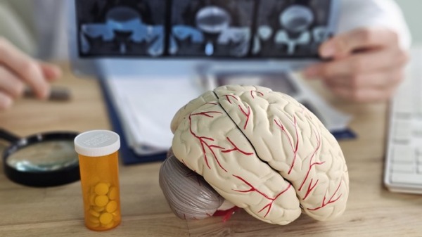 35 forskare: Stort svek mot Sveriges Alzheimerpatienter